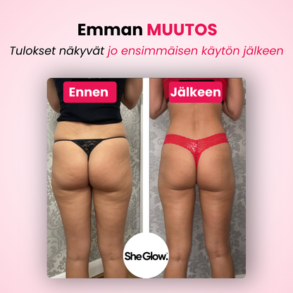 SheGlow™ PRO – Selluliitinpoistolaite